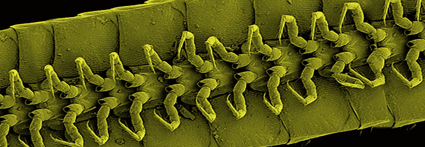 A close-up view of the tiny legs under a millipede.